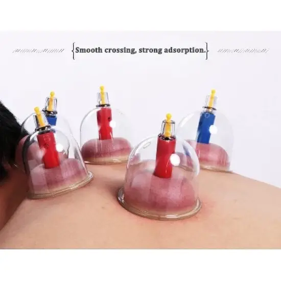 Kangzhu 24-Cup Biomagnetic Chinese Cupping Therapy Set, Multicolored image {6}