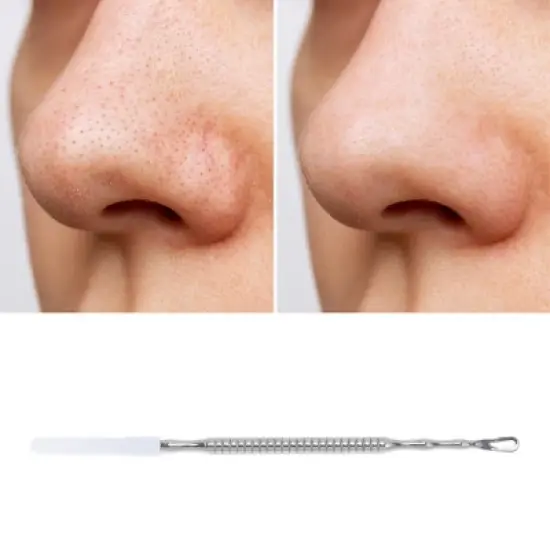 Unique Bargains Durable Pointed Pimple Extractor Silver Tone 1 Pc image {4}