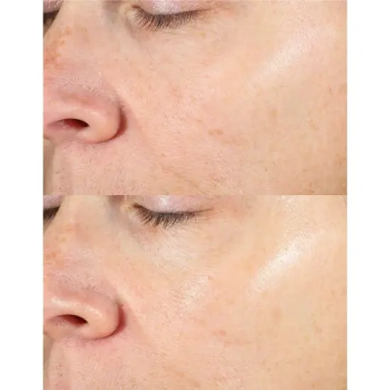 derma e Vitamin C Serum - 2 fl oz image {7}