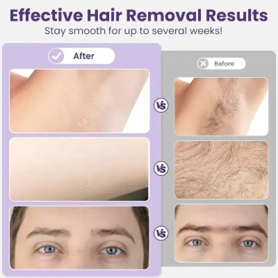 Heynemo Waxing Kit, Brazilian Wax Warmer for Hair Removal with 5 Bag Hard Wax Beads, Digital Display Melt Warmer Kit for Women Men Full Body, White image {3}