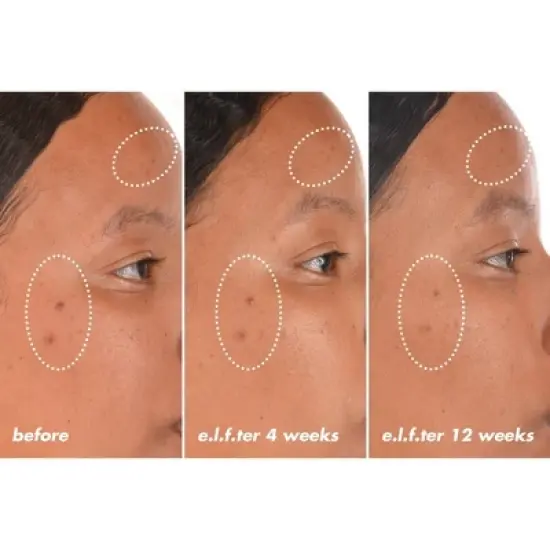 e.l.f. SKIN Bright Icon Vitamin C + E + Ferulic Face Serum - 1 fl oz image {2}