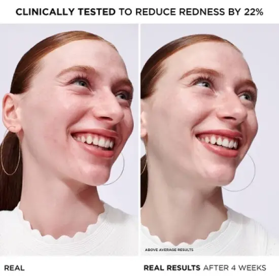 IT Cosmetics Bye Redness Serum - 1 fl oz - Ulta Beauty image {3}