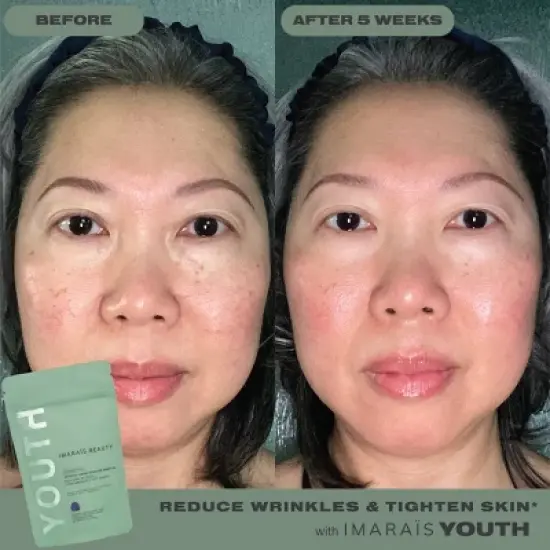 Imarais Beauty Youth Anti-Aging Gummies for Wrinkles, Discoloration - Vegan and Sugar-Free - 30ct image {5}