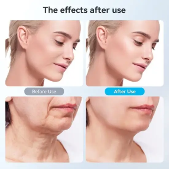 CARER SPARK Face Massager Against Wrinkles, 4-in-1 RF Neck Face Massager Face Shaper Wave Vibration Light for Anti-Ageing Lifting image {3}