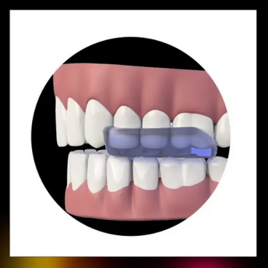 DenTek Ultimate Dental Guard For Nighttime Teeth Grinding with SmartFit Tray image {2}