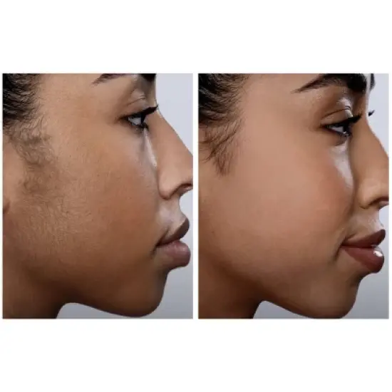 Spa Sciences SIMA Dermaplaning Replacement Safety Tips - 6ct image {4}