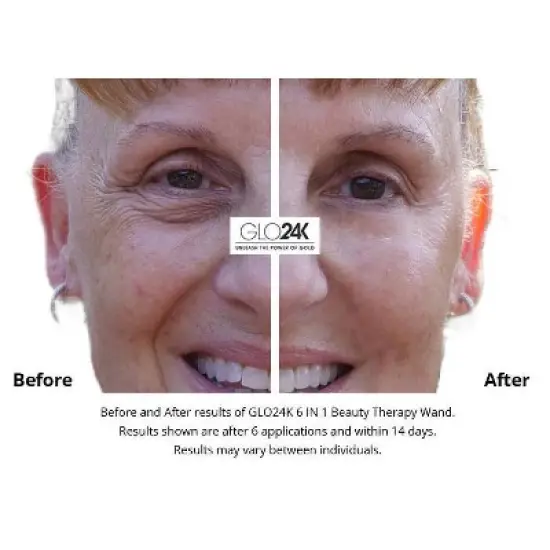 GLO24K 6-in-1 Beauty Therapy Wand for Face Eyes and Neck image {7}