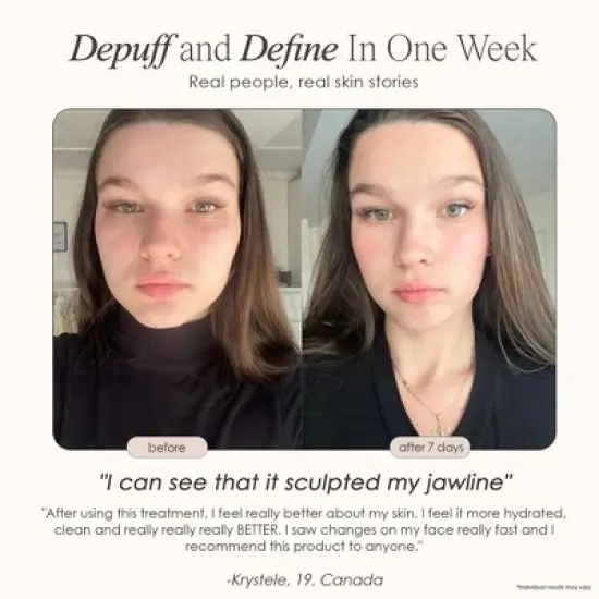 Project E Beauty Ice Roller For Face Cold Therapy | Face Massager | Eye Body Massage Under Eye Puffiness Brightening Cooling Cool Tightening | Facial image {3}