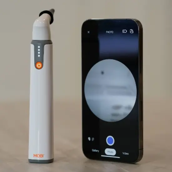 MOBI Wi-Fi Otoscope for Baby 1080P HD Camera, 6 LED, Ear Nose Throat Scope + Cleaning Tools image {7}