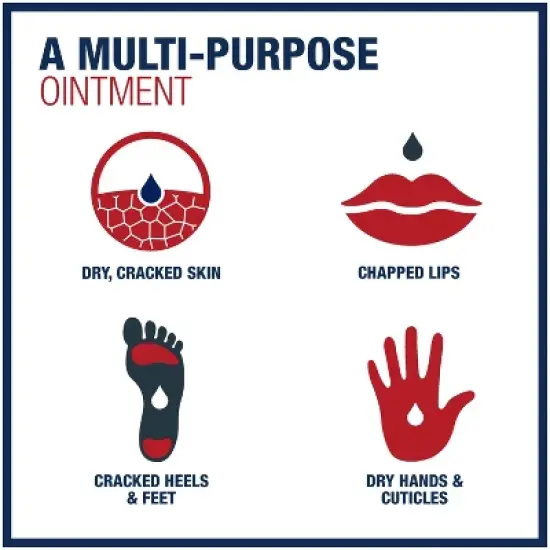 Aquaphor Advanced Therapy Healing Ointment - 1.75oz image {8}