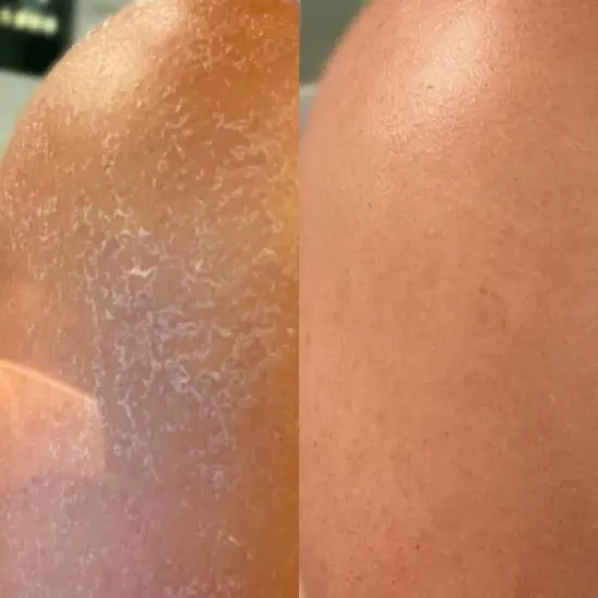 Kopari Jumbo Ultra Restore Body Butter - 12oz - Ulta Beauty image {3}