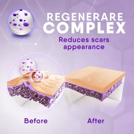 Cicatricure Scar Gel 1oz image {4}