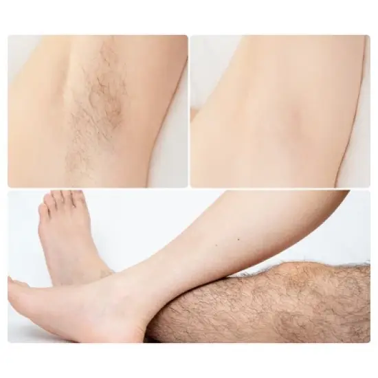 Unique Bargains Hair Eraser for Women and Men Hair Removal Tool for Arms Legs Painless Exfoliation Yellow 18x5x0.9cm 1 Pcs image {1}