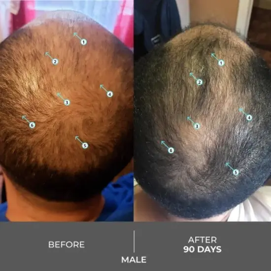 Revita | Extra Strength Hair DENSITY Shampoo image {7}