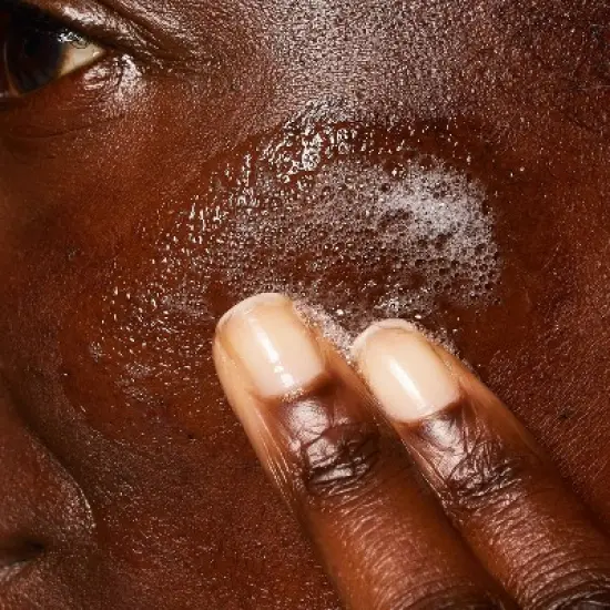 CeraVe Acne Face Wash with 2% Salicylic Acid Cleanser with Purifying Clay for Oily Skin - 8 fl oz image {1}