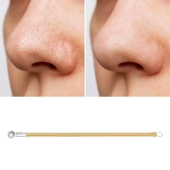 Unique Bargains Facial Double-headed Pimple Extractor 1 Pc image {2}