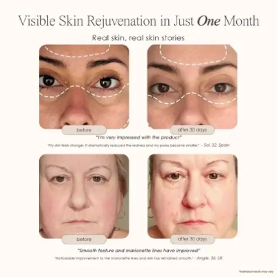 Project E Beauty Lumamask Pro Led Light Therapy Face Mask | Red Light Therapy | Blue Led Face Mask | Collagen Boost | Anti-Wrinkle image {2}