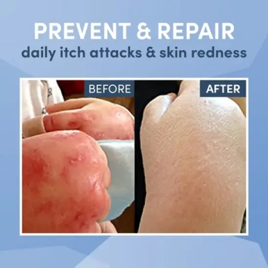 AD Rescue Wear Eczema Clothing for Toddlers - White Long Sleeve Bodysuit for Young Kids - Itch Relief, Ultra-Soft (3 Years) image {5}