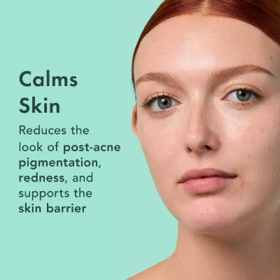 Rael Miracle Clear Complete Acne Treatment Face Serum - 1oz image {4}