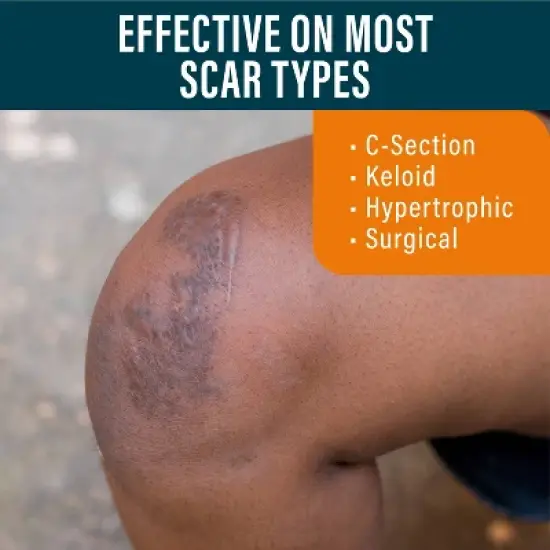 Nuvadermis Medical Grade Water Resistant Reusable Silicone Scar Sheets - Dark Skin Tone - 4ct image {3}