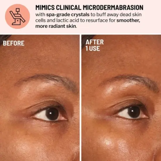 Dr. Brandt Advanced Microdermabrasion Face Exfoliator - Refines Texture, Minimizes the Look of Fine Lines & Enhances Overall Skin Tone image {1}