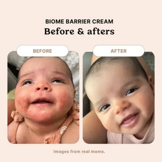 Roe Wellness Biome Barrier Cream for Baby- 4oz image {4}