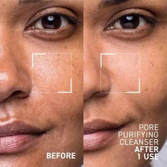 Dr. Brandt Pores No More, Pore Purifying Cleanser - Non-Drying Gel - Helps to Minimize the Appearance of Pores & Dissolves Impurities image {1}