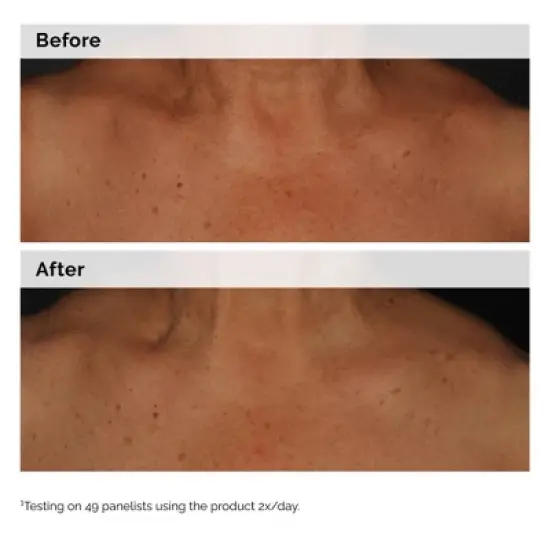 The Ordinary Niacinamide 5% Face and Body Emulsion for Dark Spots & Uneven Tone - 3.3 fl oz - Ulta Beauty image {3}