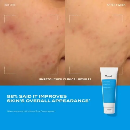Murad Acne Clarifying Face Cleanser - Ulta Beauty image {4}