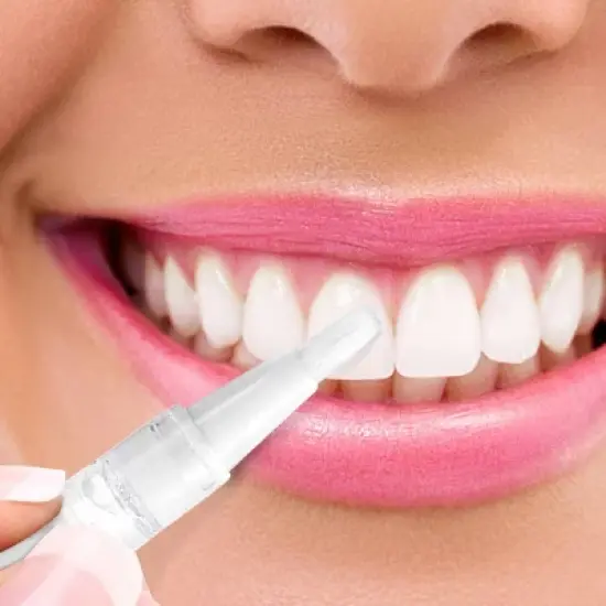 iSmile Teeth Whitening Pen image {3}