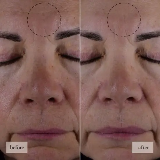 philosophy HIAJ Face Moisturizer - Travel Size - 0.5 fl oz - Ulta Beauty image {3}