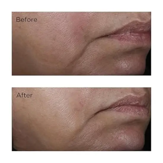 ETUDE - Soon Jung pH 5.5 Relief Toner | Skin Care Solution | Low PH Toner for Sensitive Skin | Non-Comedogenic - (6.76 oz) image {3}