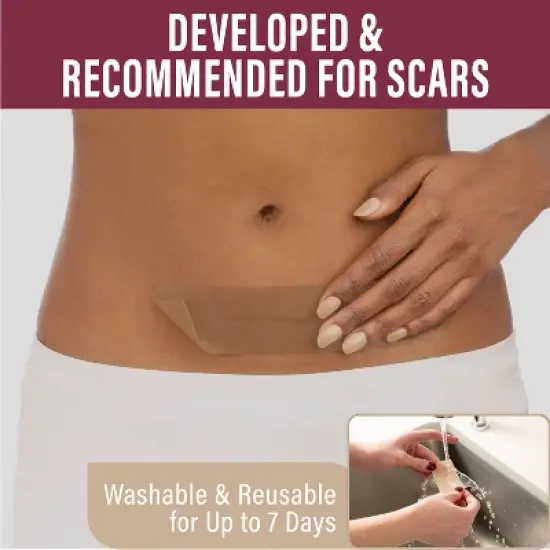 Nuvadermis Medical Grade Water Resistant Reusable Silicone Scar Sheets - Medium Skin Tone - 4ct image {2}