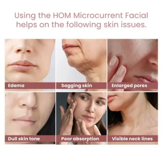 HOM Microcurrent Facial Device - Rechargeable Microsculpt Device for Face and Neck - For Skin Tightening, Face Sculpting, and Wrinkle Removal image {7}