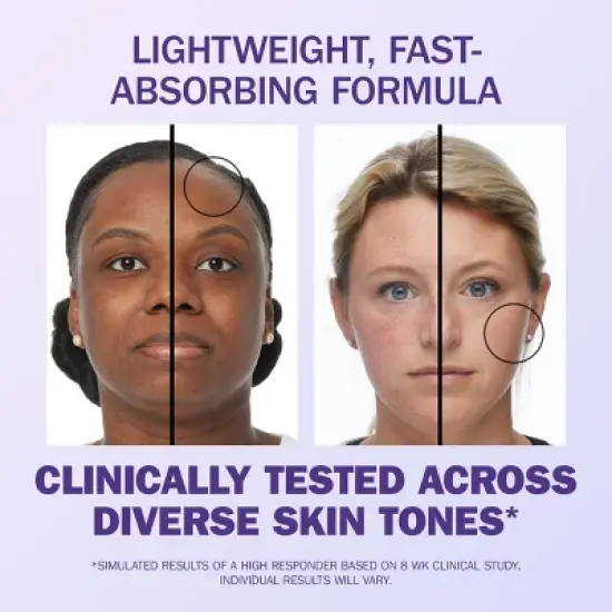 Olay Super Serum 5 in 1 Benefit Face Serum - 1 fl oz image {4}