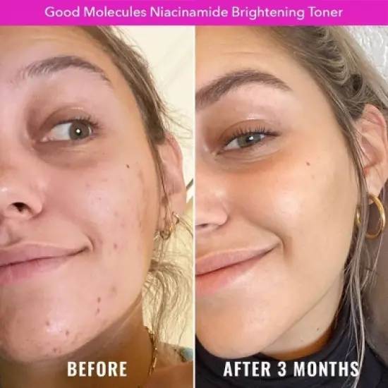 Good Molecules Niacinamide Brightening Face Toner image {2}