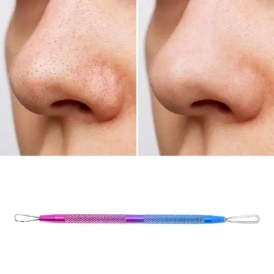 Unique Bargains Durable Nano Pimple Extractor Blue Purple 1 Pc image {4}