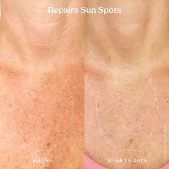 Kopari Ultra Renewal Retinol Body Cream - 4.7 fl oz - Ulta Beauty image {13}