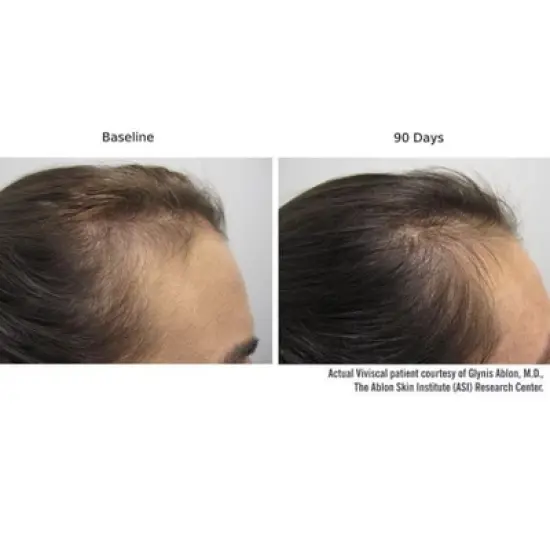 Viviscal PRO Advanced Hair Health PROFESSIONAL STRENGTH Dietary Supplements (60 tablets) AminoMar Marine Complex & Biotin image {8}