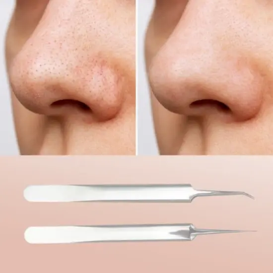Unique Bargains Facial Pimple Extractor Tool Kit 1 Set image {4}