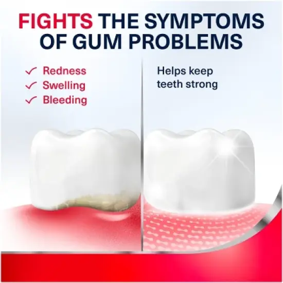 Parodontax Fluoride Anticavity & Antigingivitis Complete Protection Fresh Toothpaste - Mint -  3.4oz/3pk image {5}