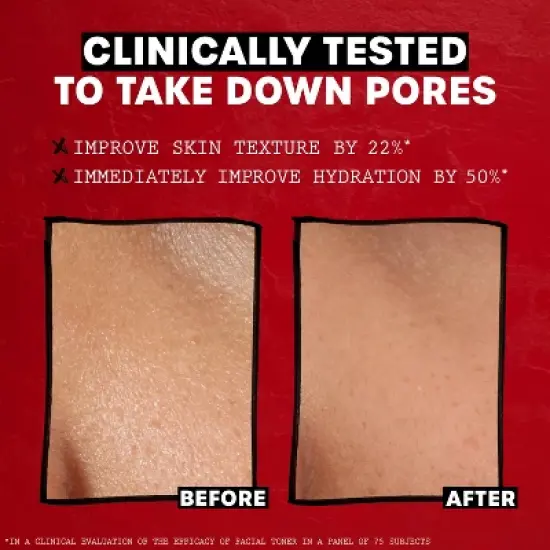 Thayers Natural Remedies Witch Hazel Alcohol Free Toner with Rose Petal image {4}