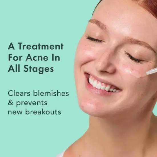 Rael Miracle Clear Complete Acne Treatment Face Serum - 1oz image {2}