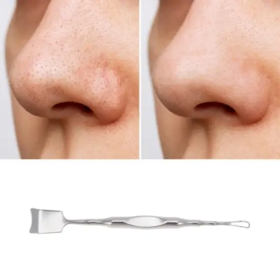 Unique Bargains Facial Pimple Extractor Silver Tone 1 Pc image {4}