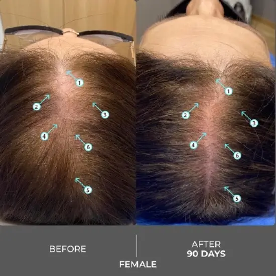 Revita | Extra Strength Hair DENSITY Shampoo image {8}