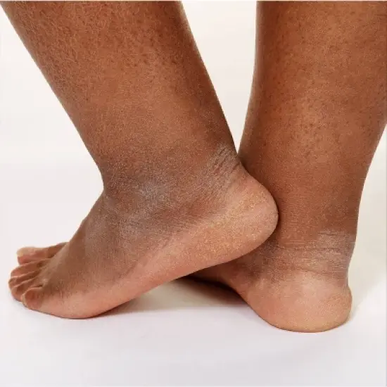 CeraVe Healing Ointment, Moisturizing Petrolatum Skin Protectant for Dry Skin Unscented - 3oz image {6}