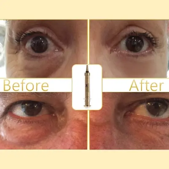 GLO24K Instant Facelift Cream with 24k Gold, Hyaluronic Acid, Peptides, and Vitamins, A,C,E. A Powerful Non-Invasive & Easy Alternative to Injections image {5}