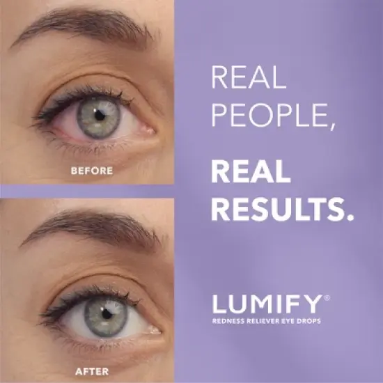 Lumify Eye Drops for Redness Relief - 2.5ml image {3}