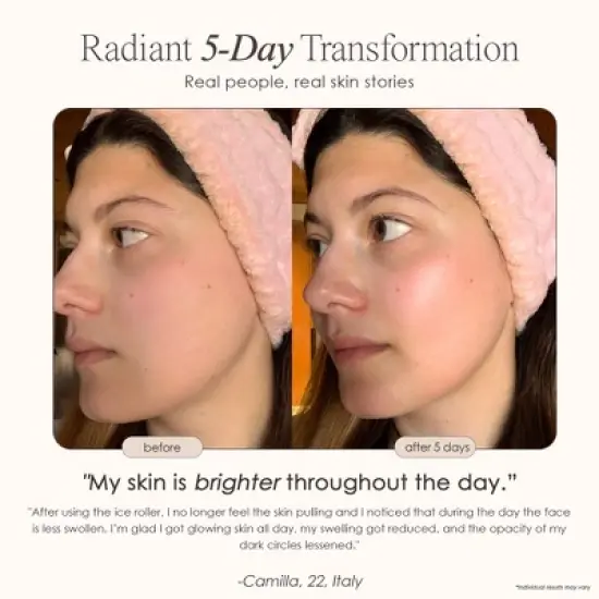 Project E Beauty Ice Roller For Face Cold Therapy | Face Massager | Eye Body Massage Under Eye Puffiness Brightening Cooling Cool Tightening | Facial image {2}