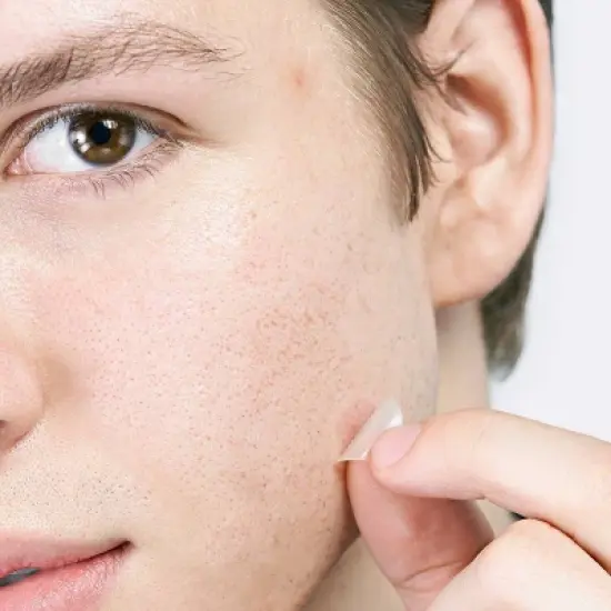 Hero Cosmetics Mighty Acne Pimple Patch Micropoint for Blemishes - 8ct image {8}